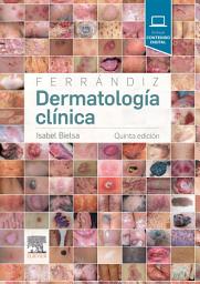 Icon image Ferrándiz. Dermatología clínica: Edición 5