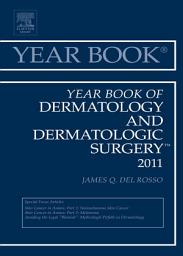 Icon image Year Book of Dermatology and Dermatological Surgery 2011