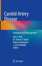 Icon image Carotid Artery Disease: Evaluation and Management