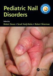 Icon image Pediatric Nail Disorders