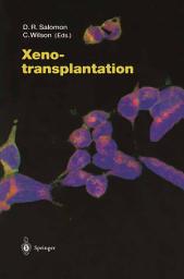 Icon image Xenotransplantation