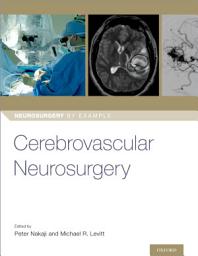 Icon image Cerebrovascular Neurosurgery