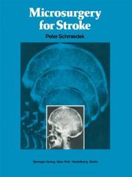 Icon image Microsurgery for Stroke