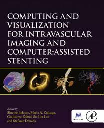 Icon image Computing and Visualization for Intravascular Imaging and Computer-Assisted Stenting