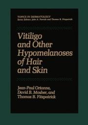 Icon image Vitiligo and Other Hypomelanoses of Hair and Skin